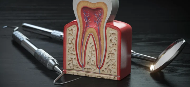 Endodontics & Root Canals