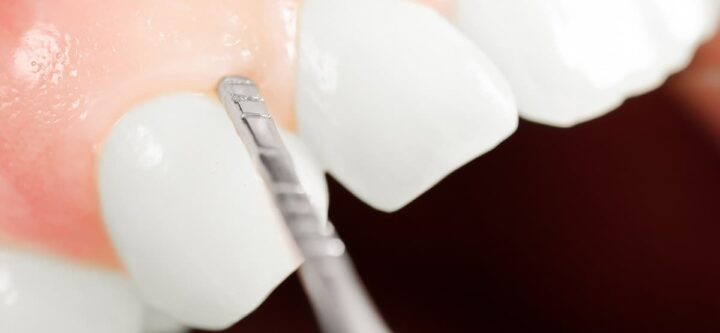 Periodontics