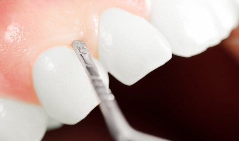 Periodontics Periodontics